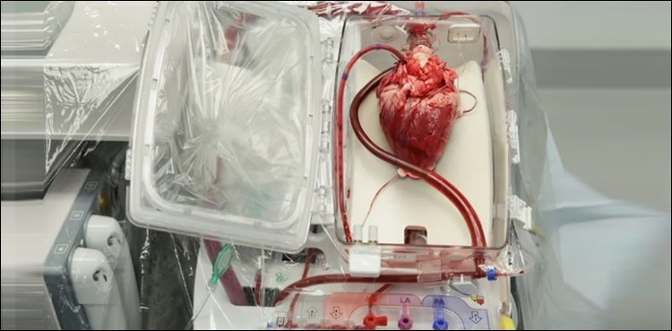 David Bennett's pig heart became infected with which virus after transplant? 1652696155 201 David Bennetts pig heart became infected with which virus after