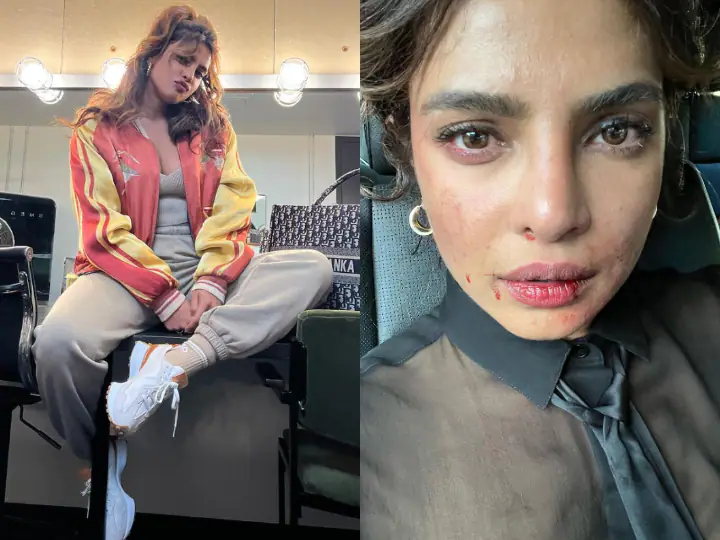  Did Priyanka Chopra's face hurt during filming?  share this photo

