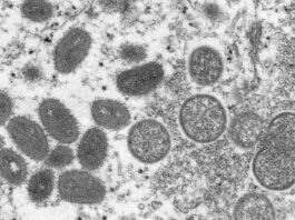 First case of monkeypox detected in Israel
