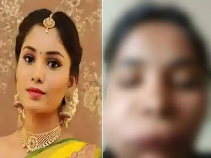 Kannada actress Swati Satish's face was damaged due to wrong surgery, hard to recognize

