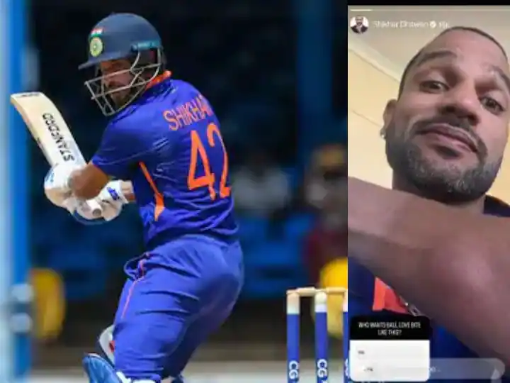  Shikhar Dhawan gets a 'love bite' in Zimbabwe!  Who wants to share photos on social networks?


