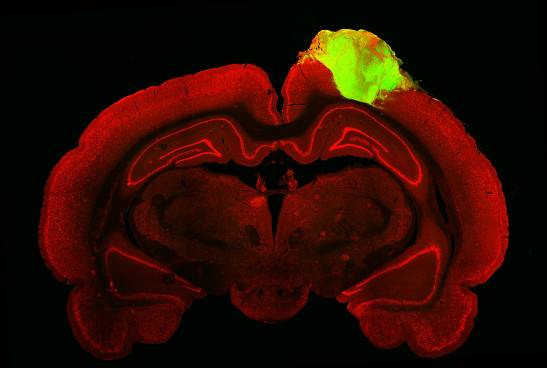 Human brain organoids respond to visual stimuli when transplanted into mice

