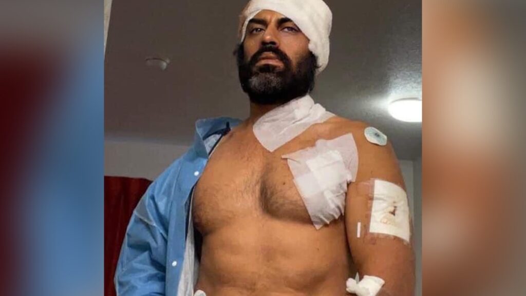 Indian actor Aman Dhaliwal attacked in US gym