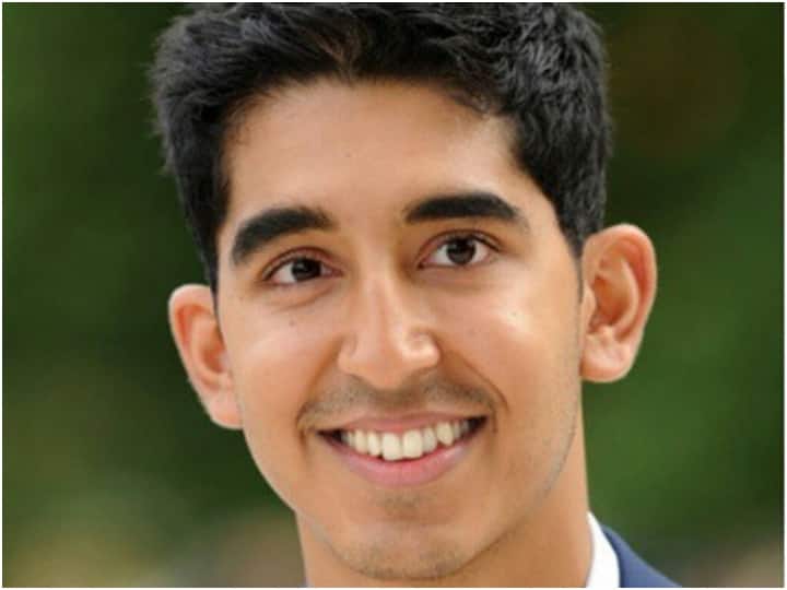 Dev Patel always proved the best in second choice, repeatedly accused of taking the role of real Indian from him.

