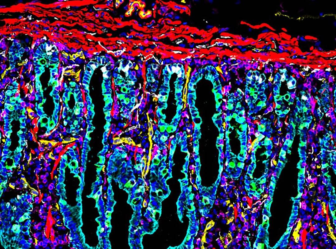 Three atlases of the kidney, intestine and placenta are created at single cell resolution Cellular imaging of the small intestine