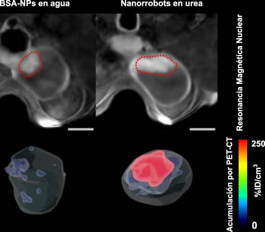 Bladder tumors are reduced by 90% through the use of nanorobots

