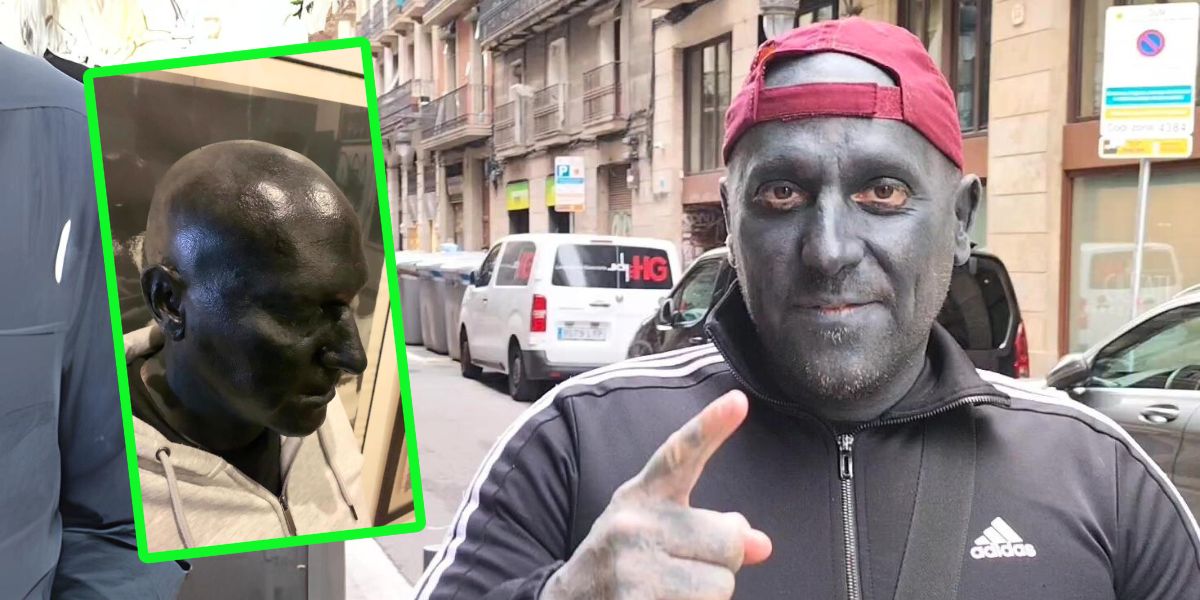 A man has his entire head tattooed black and says he suffers from racism

