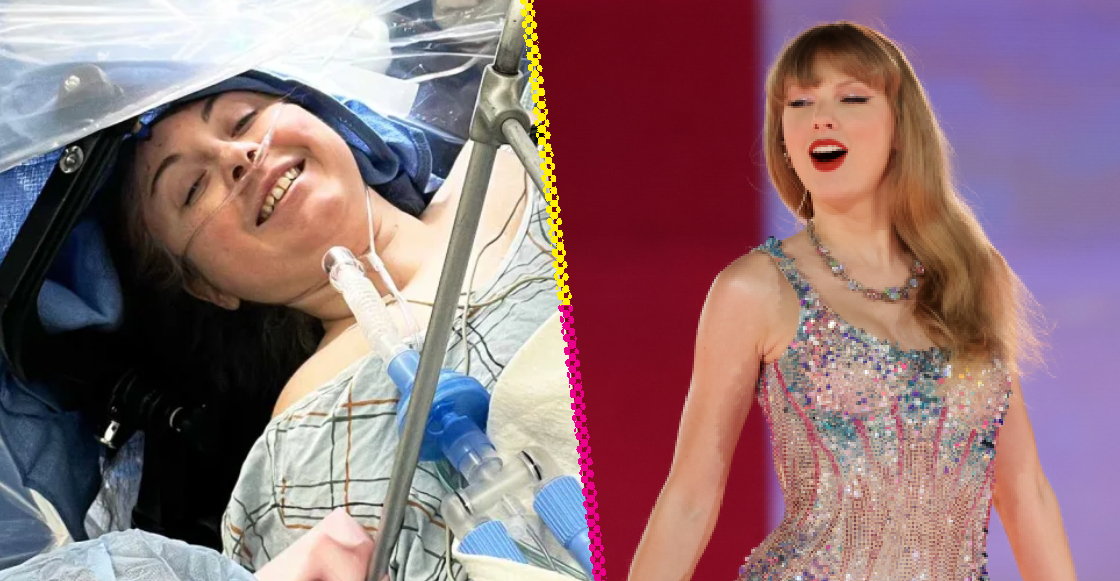 Wow! Mom sings Taylor Swift songs during brain surgery