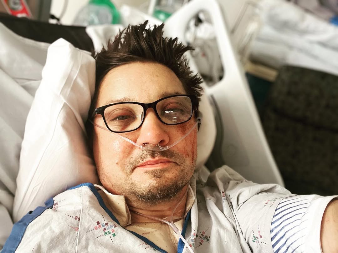 Jeremy Renner after the accident 